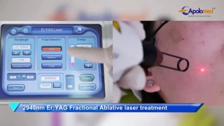 1064 Длинноимпульсный лазер для удаления волос Медицинский одобрен CE 8 в 1 Многофункциональный IPL RF Elight Q Switch Лазерное устройство ND YAG для удаления волос и удаления татуировок